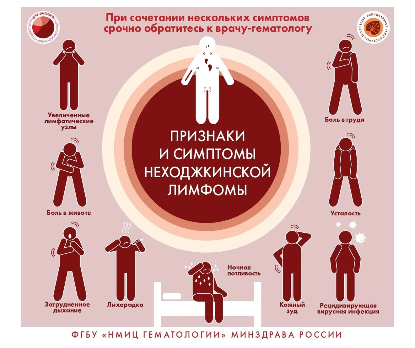 признаки  симптомы и  неходжкинской лимфомы